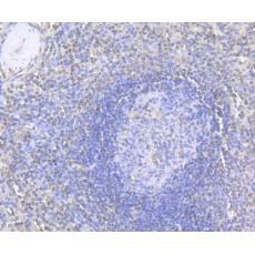 Anti-MMP9 antibody [10A1]