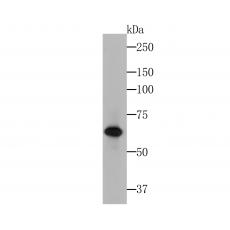 Anti-Cytokeratin 5+6 antibody [A2B2]