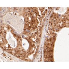 Anti-NM23 antibody [13C1]