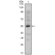 Anti-MUM1 antibody [H7-G10]