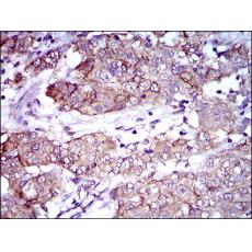 Anti-ALCAM antibody [C7-E12]