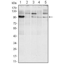 Anti-ERN1 antibody [C9-F2]