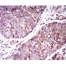 Anti-GUCY1A3 antibody [B2-G6]
