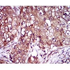 Anti-IL3RA antibody [C5-E11]