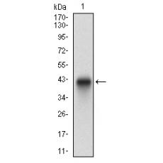Anti-PLAGL1 antibody [C5-D8]
