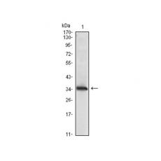 Anti-NME1 antibody [C6-B2]