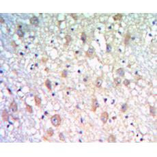 Anti-KLHL21 antibody [F4-H4]