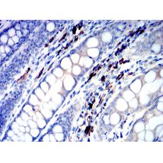 Anti-IGLC2 antibody [E12-B9]