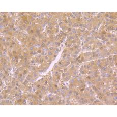 Anti-NM23 antibody [12A1]