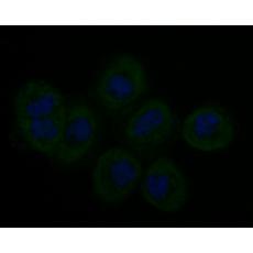 Anti-Stathmin 1 antibody [11E1]