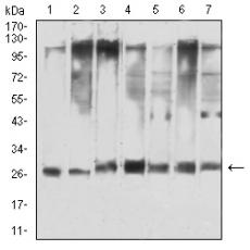Anti-YWHAQ antibody [5C4E7]