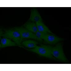 Anti-F13A1 antibody [16D1]