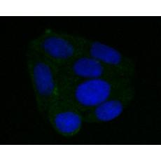 Anti-DFNA5/GSDME antibody [A1H2]