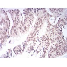 Anti-AOF1 antibody