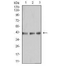 Anti-B3GAT1 antibody [B10-B8]