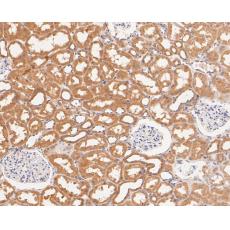 Anti-CAPZA1 antibody [A2E7]