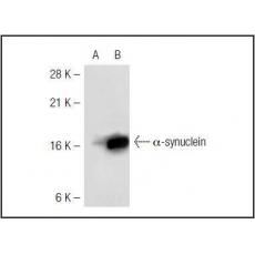 Anti-Alpha-Synuclein antibody [2G5]