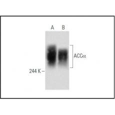 Anti-Acetyl CoA Carboxylase 1 (ACC1) antibody [2G3]