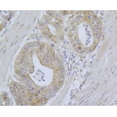 Anti-Cdk4 antibody [5-C3-G3]
