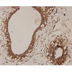 Anti-ERAS antibody [D10-B9]