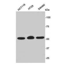 Anti-PODXL antibody [D0-E8]