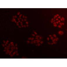 Anti-CCDC111 antibody [10-B3]