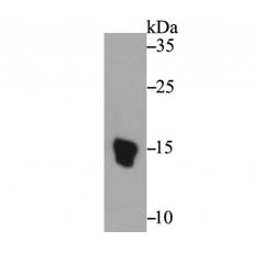 Anti-UFO antibody [C4-A8]