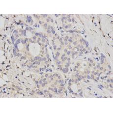 Anti-BRCA2 antibody [A2-B10]