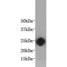 Anti-Interleukin 6 antibody [3-A4]