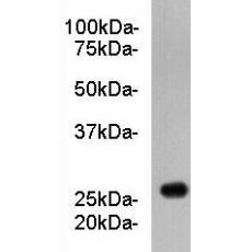 Anti-Apolipoprotein A1 antibody [B5-F11]