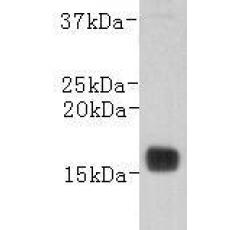 Anti-Transthyretin antibody [3-E11]