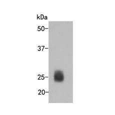 Anti-Human Iambda light chain antibody [36-59]