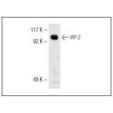 Anti-IREB2 antibody [1G3]