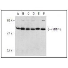 Anti-MMP-3 antibody [3G1]