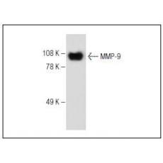 Anti-MMP-9 antibody [2G3]
