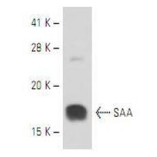 Anti-Serum Amyloid A (SAA) antibody [4G08]