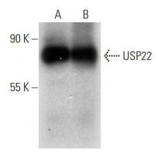 Anti-USP22 antibody [1G4]