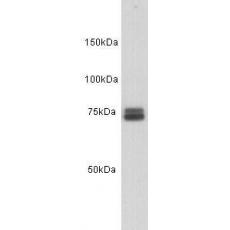 Anti-Transferrin antibody [D7-D11]