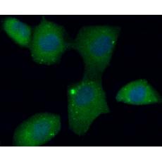 Anti-C10orf58 antibody
