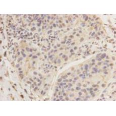 Anti-Breast cancer-overexpressed gene 1 protein antibody [A0-F3]