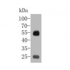 Anti-IgA antibody [A10-B5]