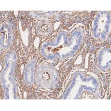 Anti-Alpha-2-macroglobulin antibody [A5-A9]