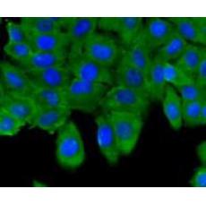 Anti-ESD antibody [J0-8]