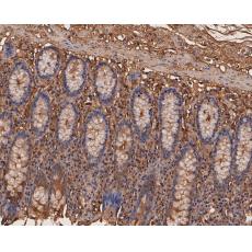 Anti-CEACAM6 antibody [A1E3]