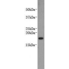 Anti-LT-alpha antibody [C2-F2]