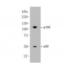 Anti-NFKB2 antibody [16B2]