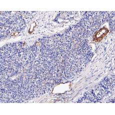 Anti-Caveolin-1 antibody [A3E8]