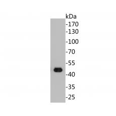 Anti-Cytokeratin 20 antibody [A3D12]