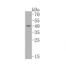 Anti-CD1A antibody [A3F9]