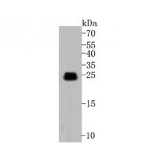 Anti-Caveolin-1 antibody [A3E7]